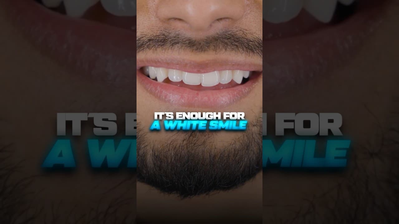 How to get a white smile in 7 days